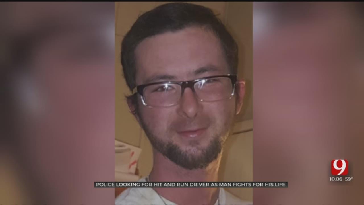 Police Searching For Hit-And-Run Driver As Pott. Co. Man Fights For His Life