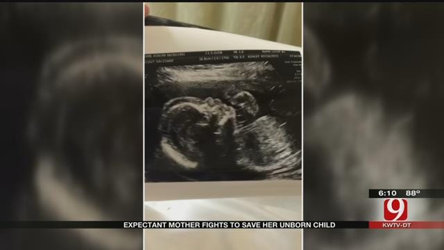 Expectant Mother Fights To Save Her Unborn Child