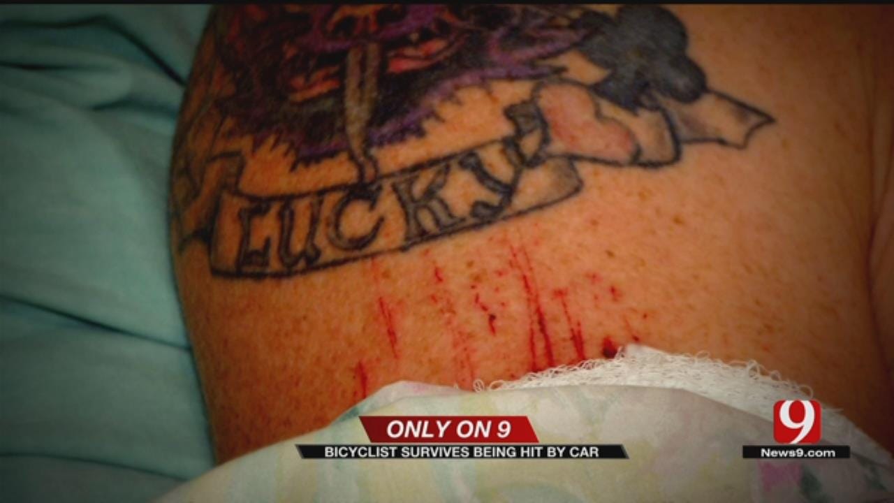 Only On 9: Bicyclist Speaks Out After Being Hit By Car In Bethany