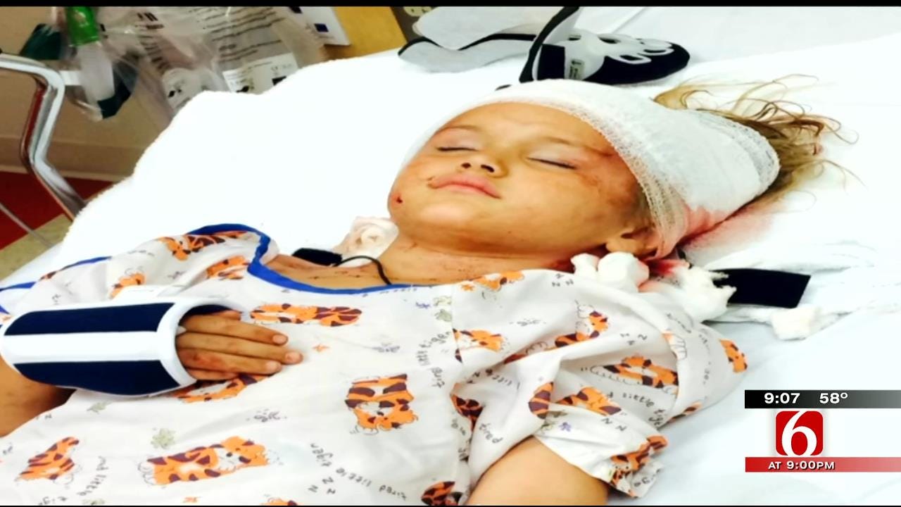 5-Year-Old Collinsville Girl Has 'Hundreds Of Stitches' After Brutal Dog Attack