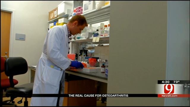 Medical Minute:The Real Cause For Osteoarthritis