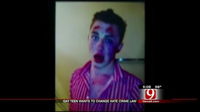 Attacked Teen Hopes To Change Oklahoma Hate Crime Laws