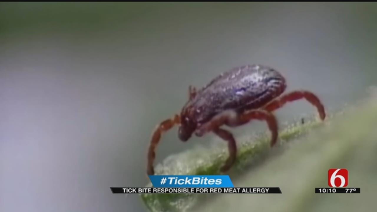 Oklahoma Woman Develops Meat Allergy After Tick Bite