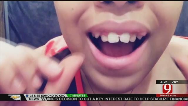 Orthodontists Warn Against DIY Braces Trend