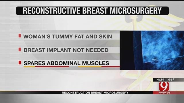 Medical Minute: Breast Reconstruction
