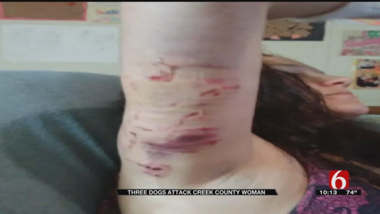 Creek County Woman Mauled By 3 Dogs Seeks Charges