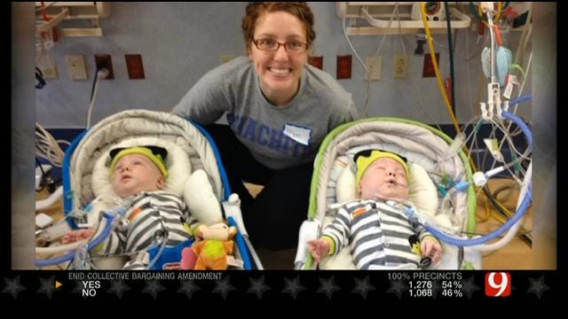 Guthrie Family Shares Conjoined Twins' Journey To Beat The Odds
