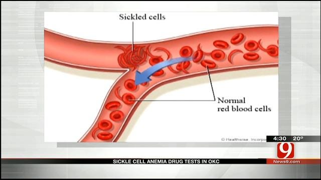 Medical Minute: Sickle Cell Anemia