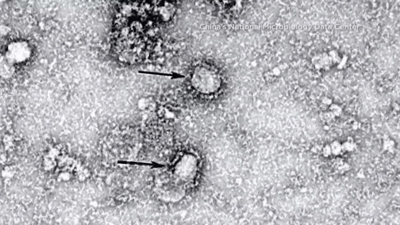 CDC Confirms 1st Person-To-Person Coronavirus Transmission