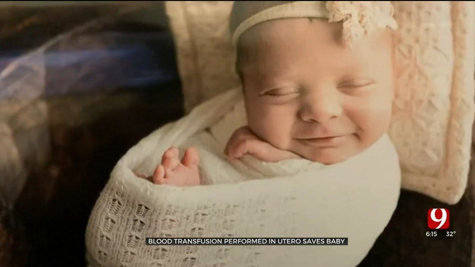 Local Baby Born After Rare In Utero Procedure Thanks To Blood Donors