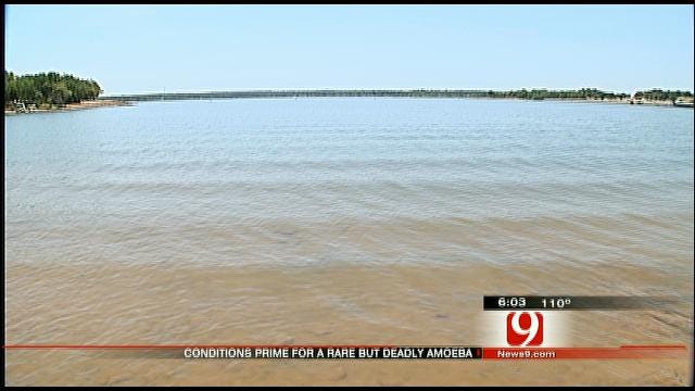 Conditions Ripe For Deadly Water Amoeba, Oklahoma Health Officials Say