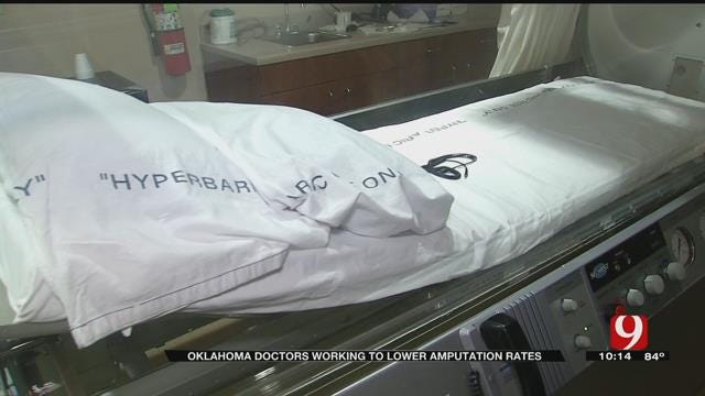 Oklahoma Doctors Work To Lower Amputation Rates