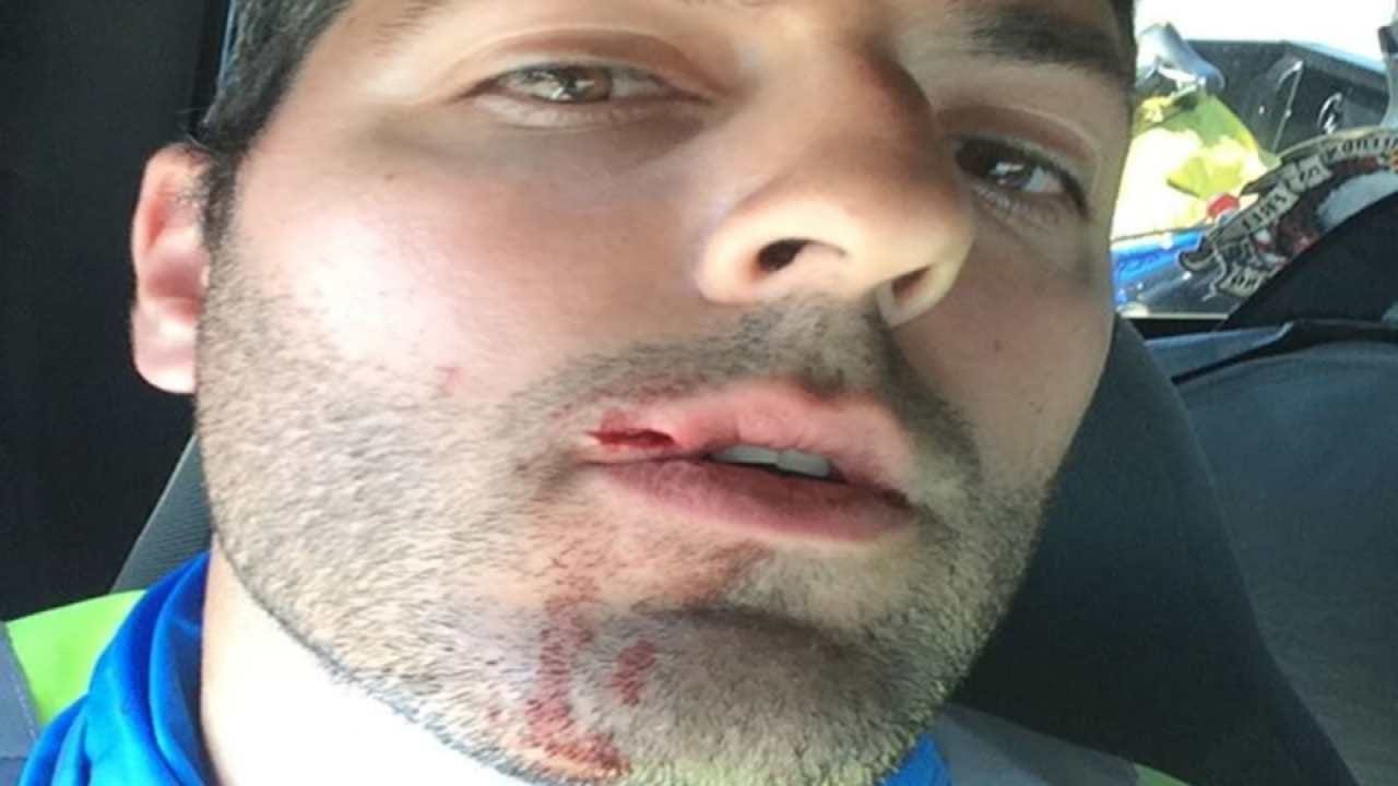 Cyclist On Cross Country Journey Punched In Face By Sapulpa Driver
