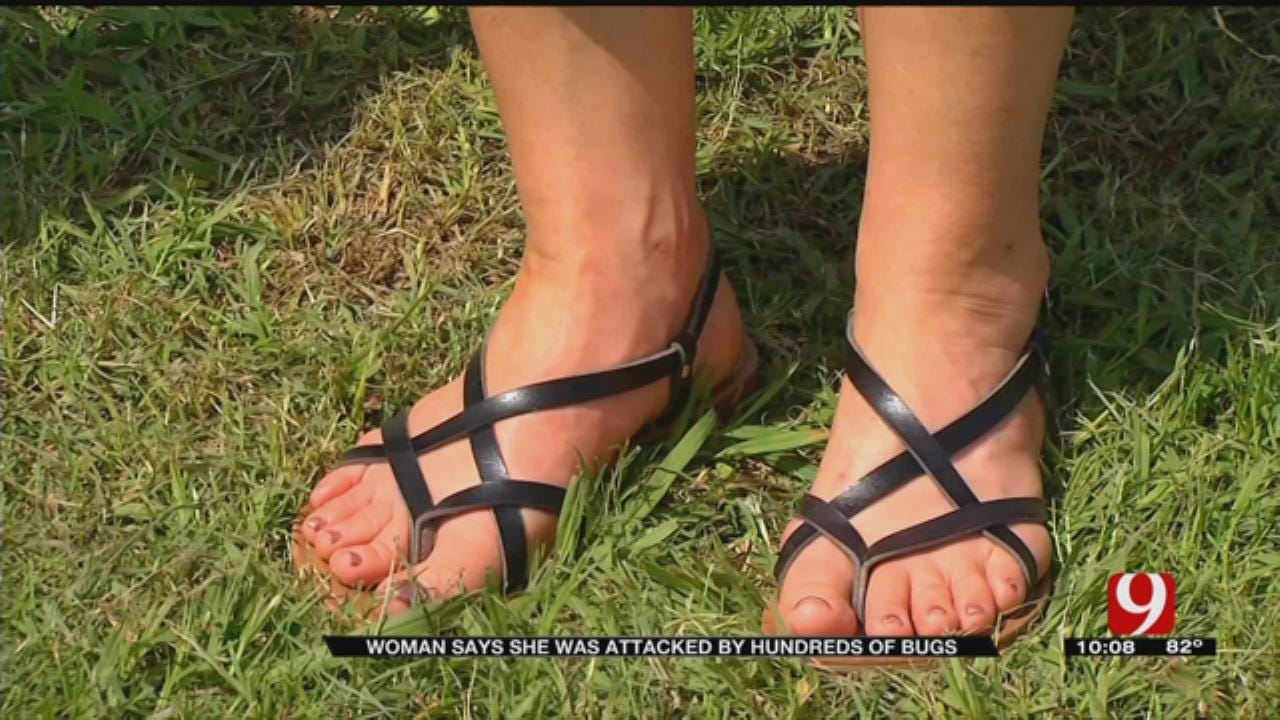 Hundreds Of Tiny Bugs Cover Oklahoma Woman’s Foot