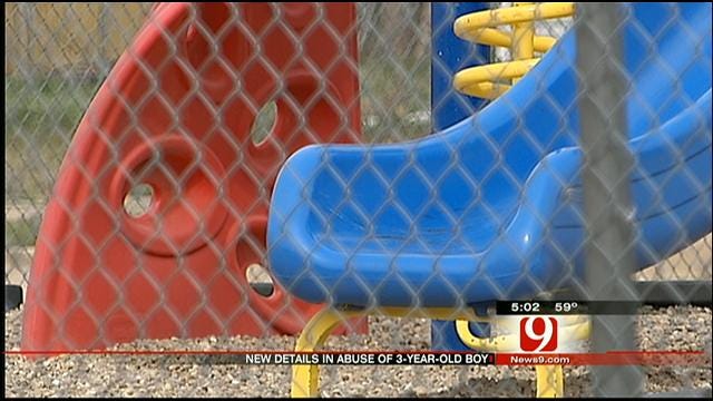 Edmond Daycare Worker Accused Of Kicking 3-Year-Old Boy, Breaking His Leg