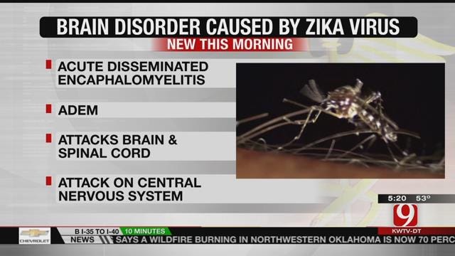 Scientists Discover New Brain Disorder Caused By Zika Virus