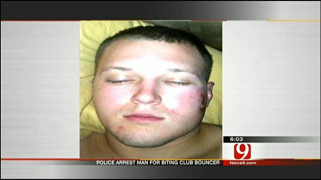 Suspect's Bite May Have Permanently Scarred Bricktown Bouncer