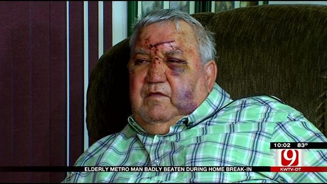 Elderly Metro Man Badly Beaten During Home Break-In