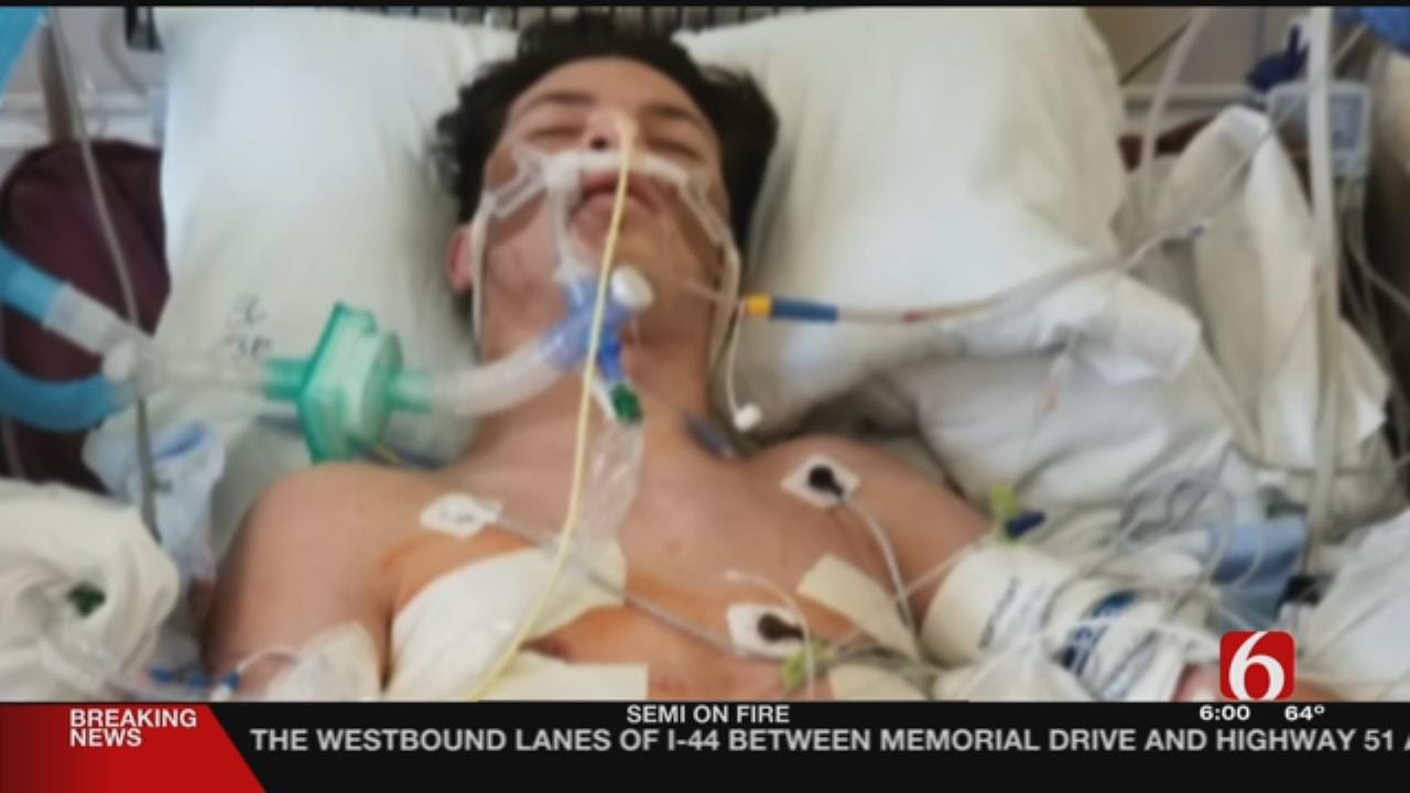 Tulsa Man Stabs Teenager Several Times, Police Say