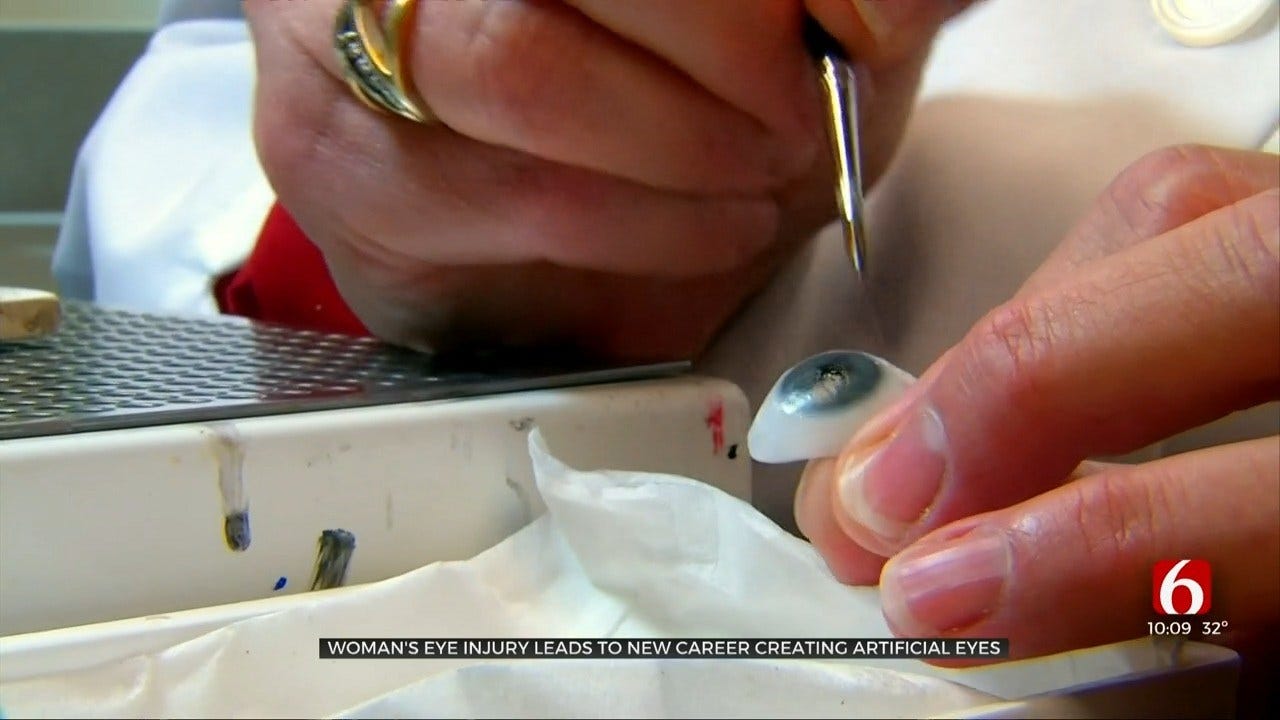 Oklahoma Artist Creates Hope For Those Who've Lost An Eye