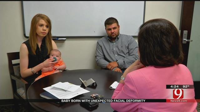 Medical Minute: Baby Born With Unexpected Facial Deformity