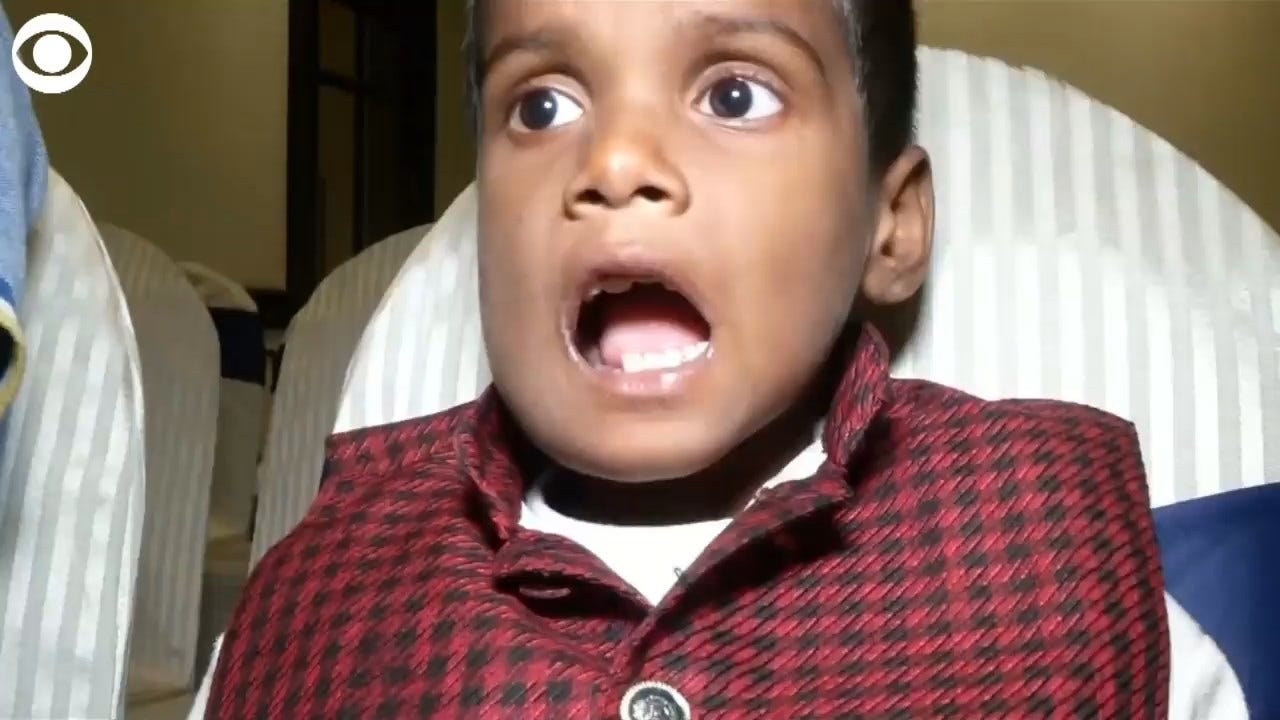 TAKE A LOOK: 7-Year-Old Boy Had 526 Teeth Removed From His Mouth