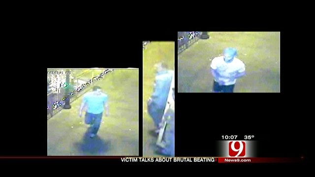 Bricktown Beating Victim Speaks Out In Hopes Of Finding Attackers