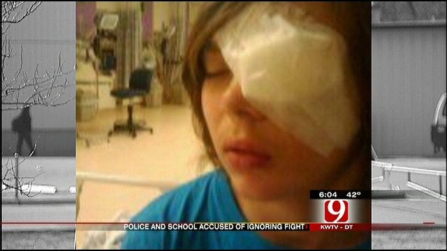 School Beating Results In Serious Injury To Tecumseh Student