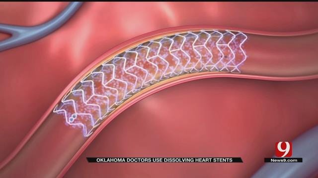 Medical Minute: New Heart Stents
