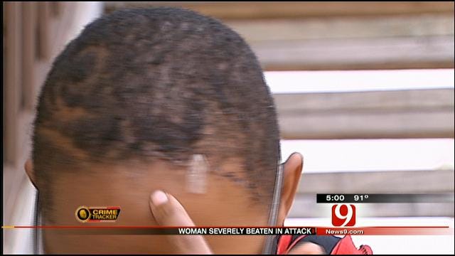 Midwest City Woman Claims She Was Attacked For Being Gay