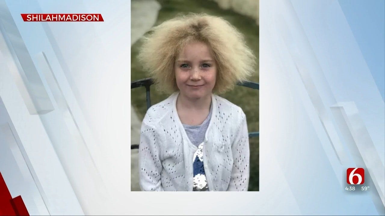 Something To Talk About: Uncombable Hair Syndrome