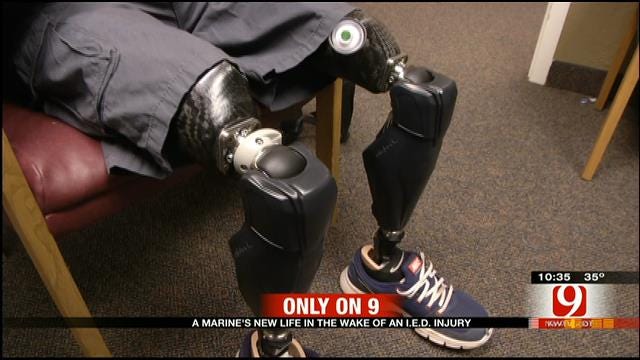 Triple Amputee UK Solider In OKC For New Prosthetics
