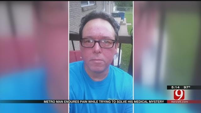 Edmond Man Endures Pain As Doctors Try To Solve Medical Mystery