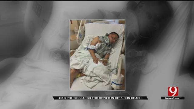 Hit-And-Run Victim Speaks Out After Auto-Pedestrian Crash