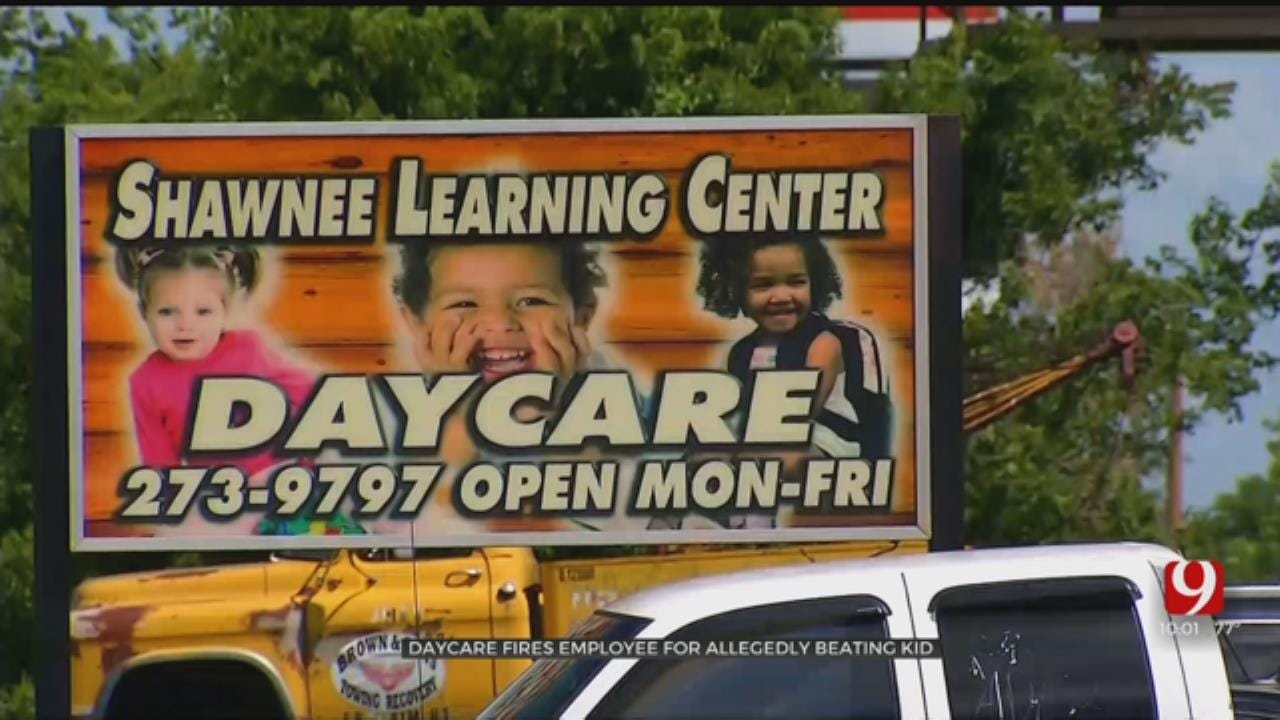 Shawnee Daycare Employee Fired, Accused Of Abusing 19-Month-Old Child