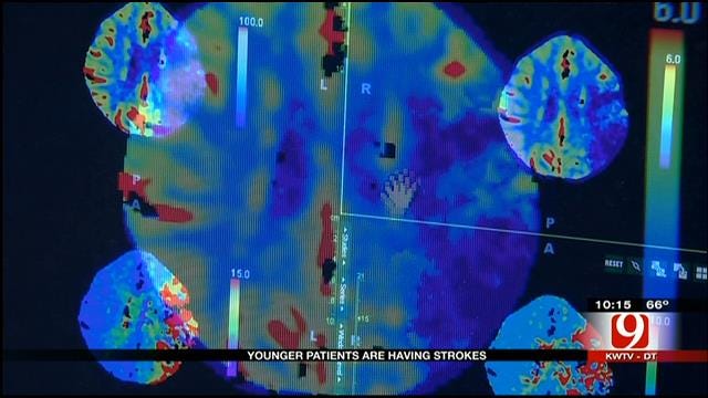 Stroke Risk Increasing Among Younger Patients In Oklahoma