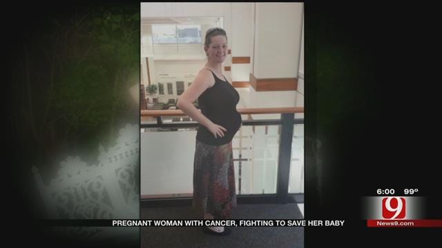 Soon-To-Be Mother Battles Stage IV Colon Cancer