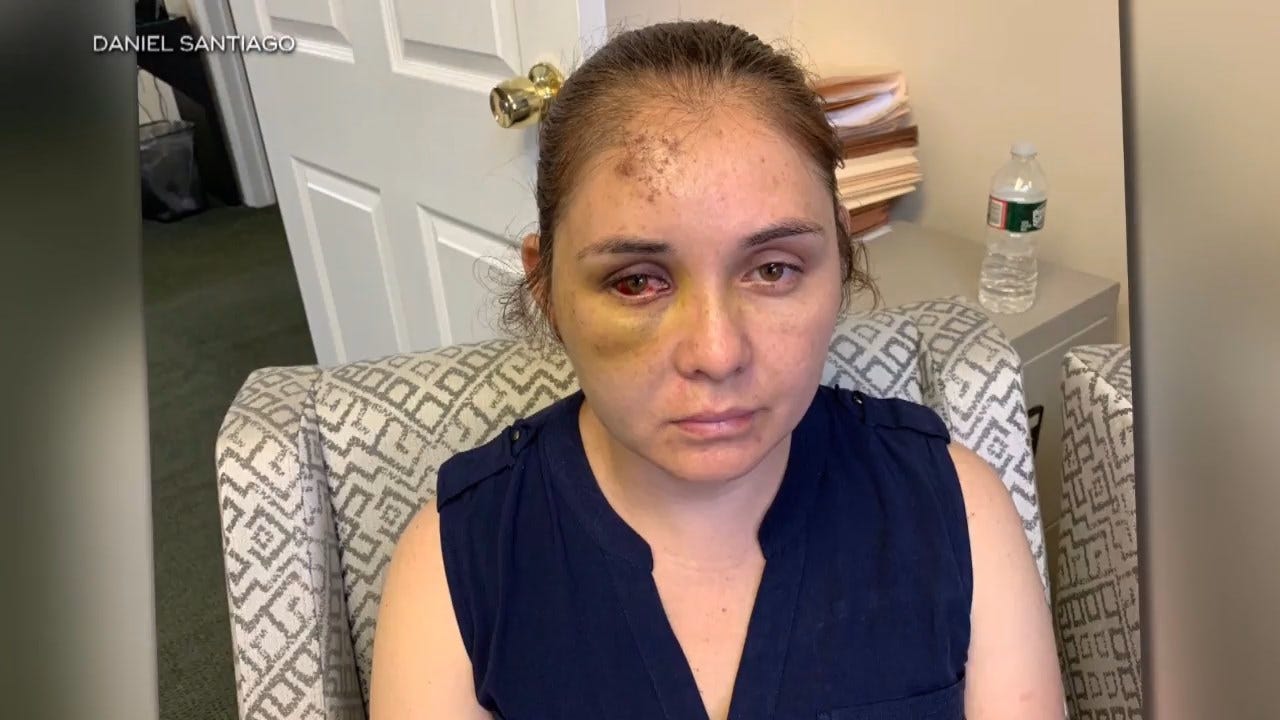 Mother Allegedly Attacked By Her Son's 13-Year-Old Bully