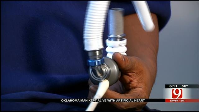 Tulsa Man Kept Alive With Artificial Heart