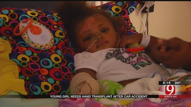 Oklahoma Girl Needs Hand transplant After Car Accident