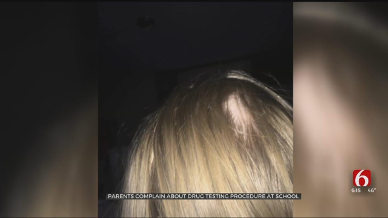 Fairfax Parents Upset After They Say Chunks Of Hair Removed In Drug Testing
