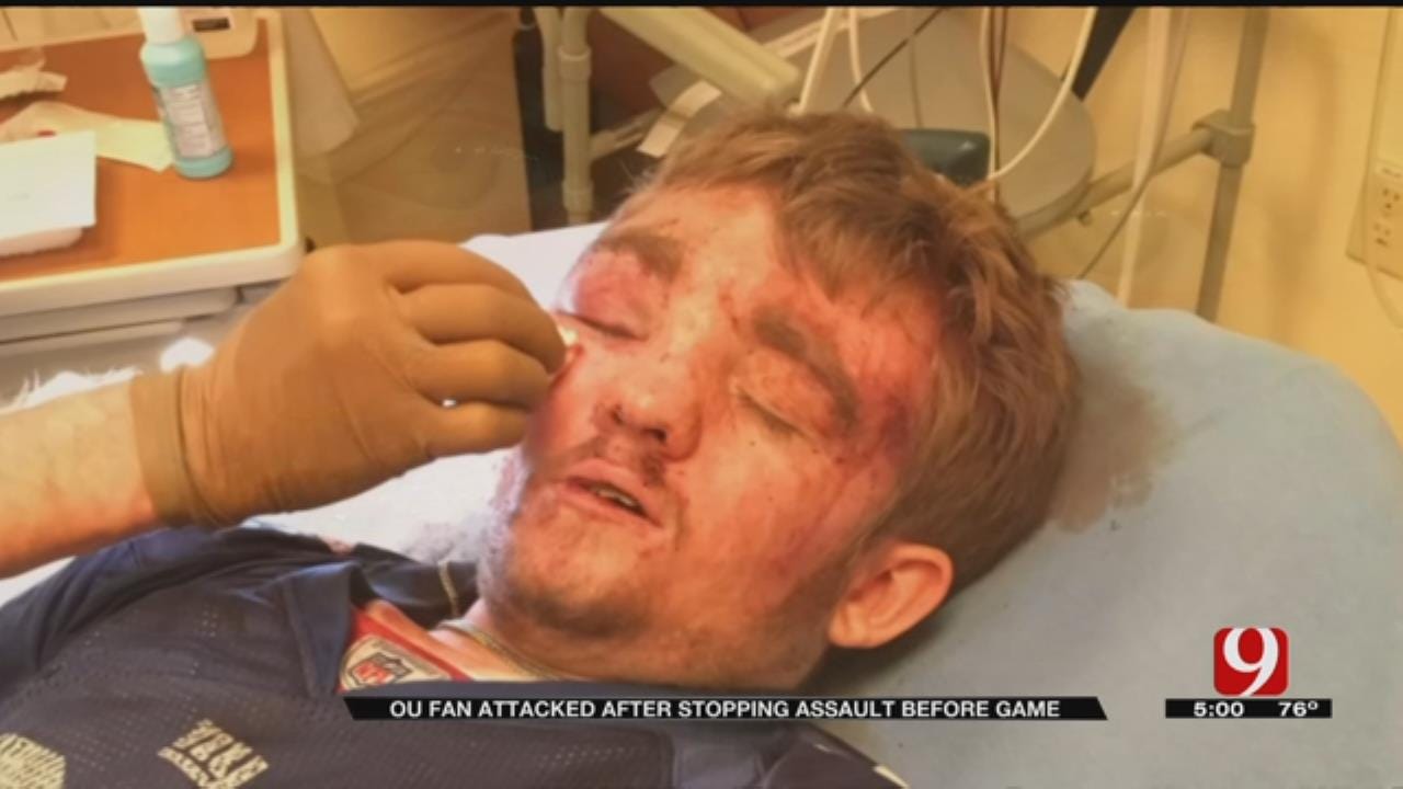 OU Fan Attacked After Stopping Assault Before Game