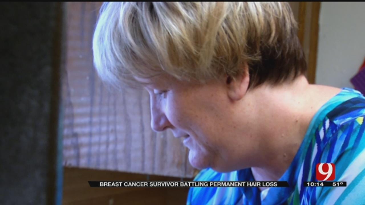 OK Cancer Survivor Joins Permanent Hair Loss Lawsuit