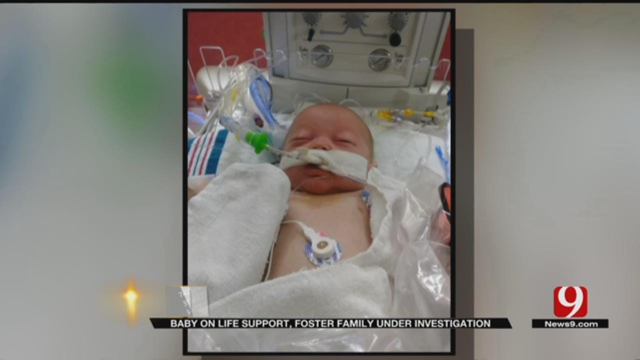 Baby On Life Support, Foster Family Under Investigation