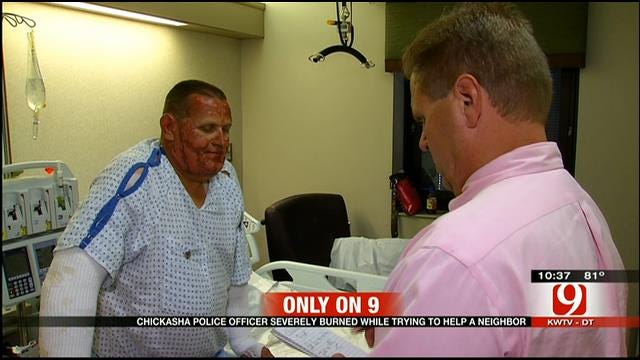 Chickasha Officer Recovering From Severe Burns