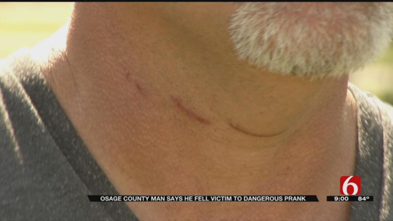 Osage County Man Says He's Lucky To Be Alive After Suspected Prank