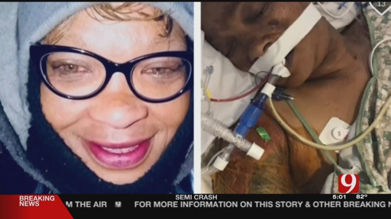GoFundMe Account Set Up For Woman Critically Injured In Pit Bull Attack