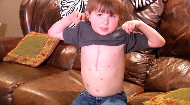 Verdigris Boy, 6, Thrives With Heart Replacement