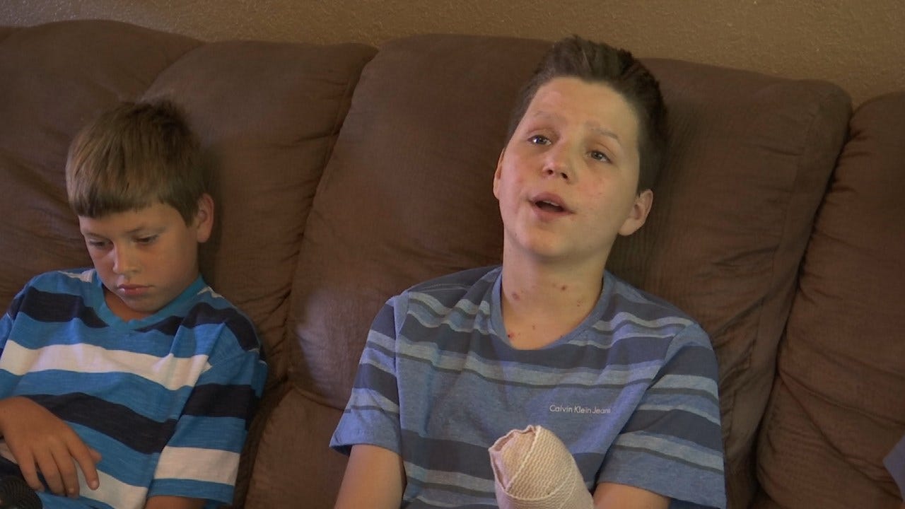 13-Year-Old Boy Loses Hand In Fireworks Accident