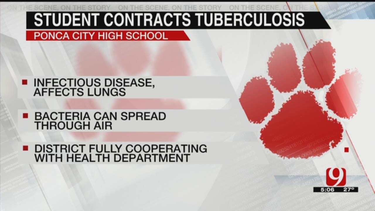Ponca City Student Tests Positive For Tuberculosis